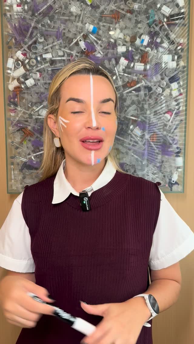 AD001 IM Labios